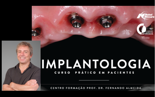 Formação de Implantologia - Lisboa Porto