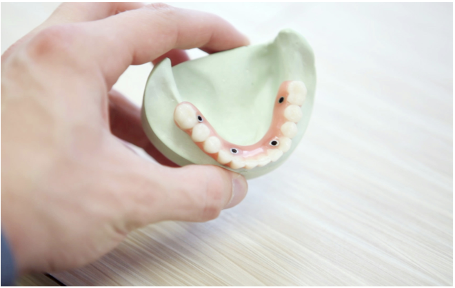 Modelo de laboratório permite que pesquisadores explorem a resposta da boca às doenças orais