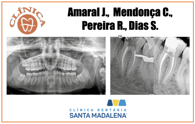 Remoção de instrumento fraturado em endodontia, a propósito de um caso clínico