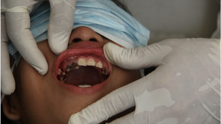 Inquérito Nacional sobre Saúde oral do Hospital Infantil C.S. Mott da Universidade de Michigan