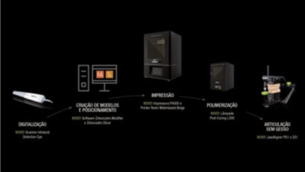 Zirkonzahn apresenta novo scanner intraoral Detection Eye