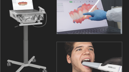 Scanner intraoral Detection Eye de Zirkonzahn para impressões digitais