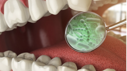 Compreender as bactérias orais para ajudar a combater a doença periodontal