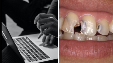 Cárie dentária em adolescentes japoneses associada ao vício da Internet