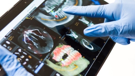 Tipos de tecnologia digital para medicina dentária