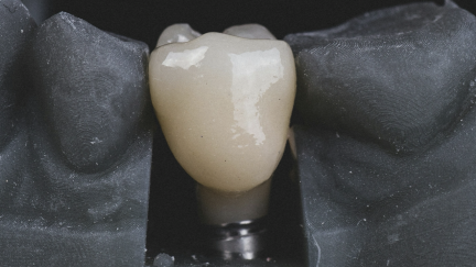 Descoberta a razão porque   os antibióticos falham contra uma doença comum nos implantes dentários
