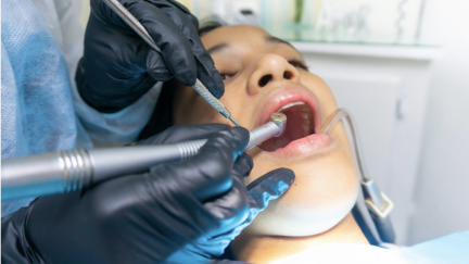 Infeção dentária silenciosa pode estar a prejudicar todo o corpo
