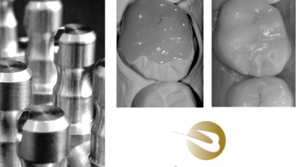 Restaurações Indiretas em Posteriores: CAD-CAM