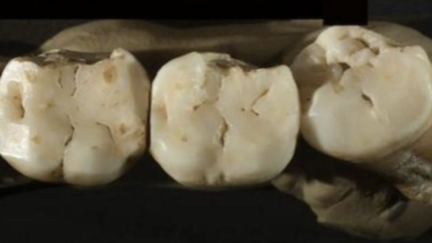 Estudo revela que os dentes podem preservar anticorpos com centenas de anos.