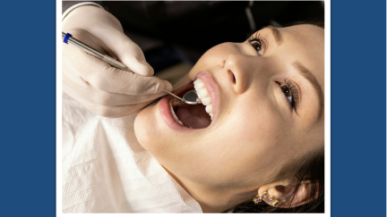 Periodontite afeta metade dos adultos após os 30 anos: especialistas alertam para riscos além da saúde oral