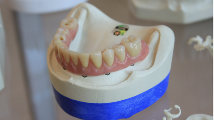 Investigação inovadora capta as realidades emocionais e sociais dos utilizadores de próteses dentárias