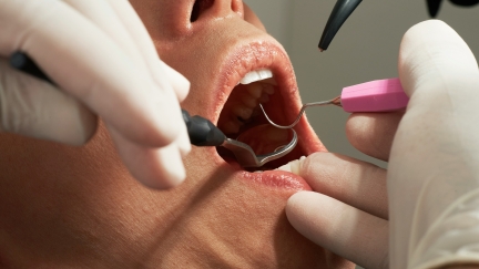 ADA — Nova diretriz detalha estratégias de controle da dor dentária para pacientes pediátricos