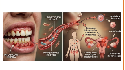 A inflamação oral pode atingir os ovários, acelerando a diminuição da fertilidade.