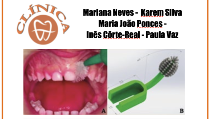 Alterações dentárias e estratégias orais preventivas nos pacientes portadores de fenda labiopalatina