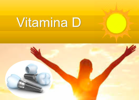 A vitamina D é crucial para o sucesso do implante dentário