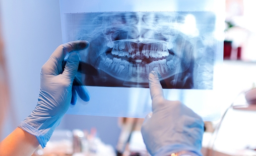O futuro da Medicina Dentária está na Inteligência Artificial (IA)?