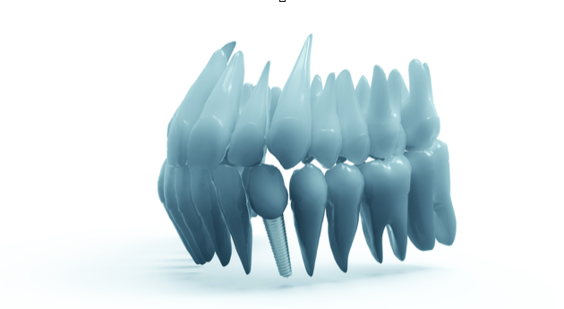 Uma nova maneira de tratar infeções de implantes à base de metal com terapia eletroquímica (ECT)