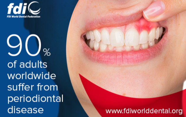 A saúde periodontal  é uma das prioridades  globais do FDI para os próximos três anos