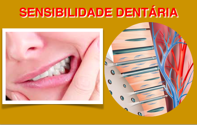 Um fim para as cáries em pessoas com sensibilidade dentária?