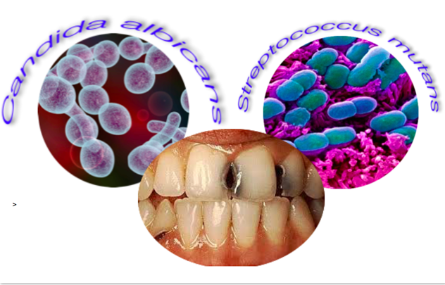 Estudo mostra que bloquear a interação Fungo/Bactéria pode evitar biofilmes perigosos que causam deterioração dentária na infância