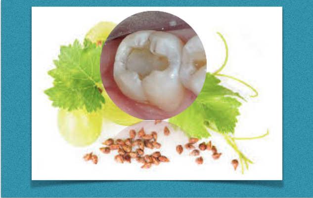 Extrato de sementes de uva pode prolongar a vida útil da restauração dentária com resina