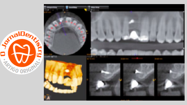 Aplicações da Tomografia Computadorizada de Feixe Cónico na Medicina Dentária