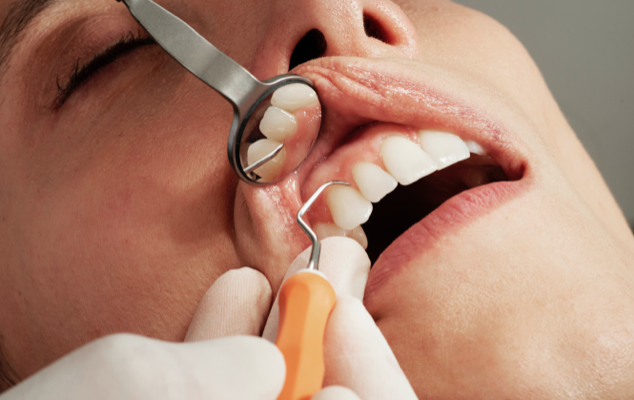 Nova pesquisa mostra que as condições dentais relacionadas com o stresse continuam a aumentar