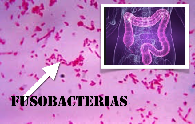 Micróbios orais pioram tumores colo-rectais