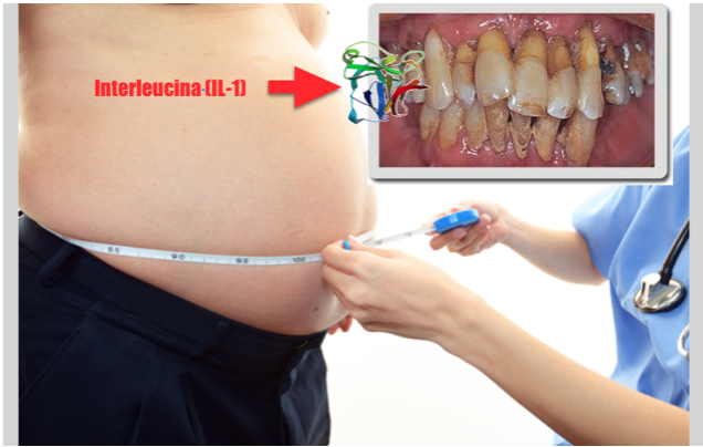 Genética pode ampliar o efeito negativo da obesidade na doença periodontal
