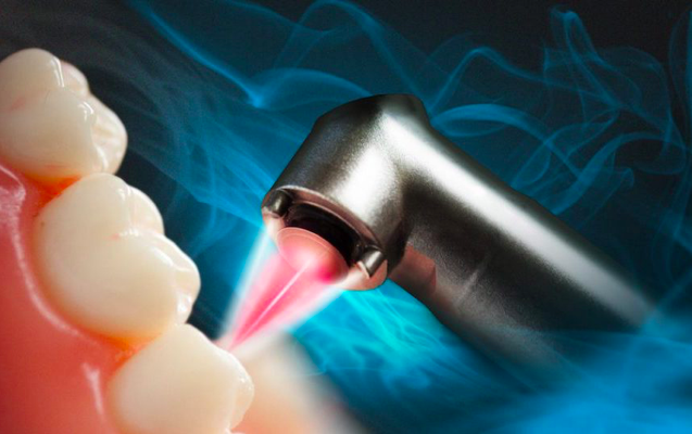 Introdução às aplicações a laser em tratamentos dentários