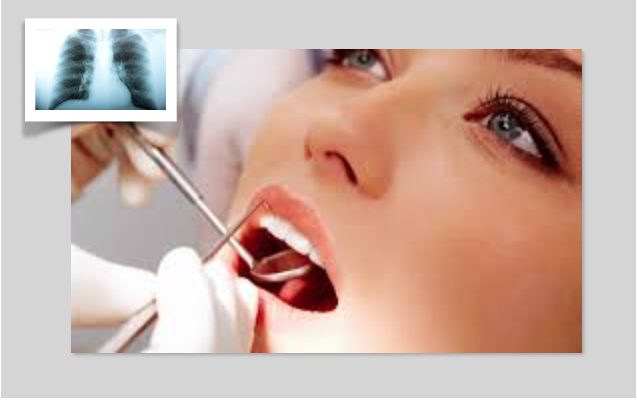 Estudo mostra que as consultas regulares ao  médico dentista ajudam a prevenir a pneumonia.