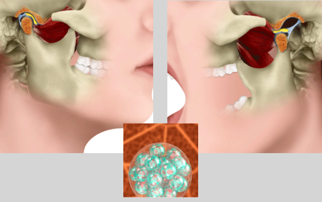 A manipulação de células estaminais é promissora para a renovação de cartilagem e reparação articular