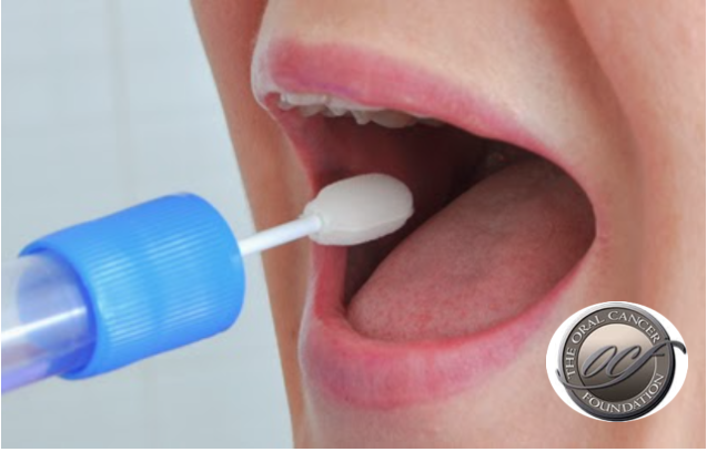 Novo teste de saliva para diagnóstico do cancro oral e da garganta recebe aprovação da FDA