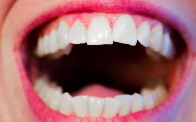 Estudo mostra que elixires orais comummente usado podem tornar a saliva significativamente mais ácida