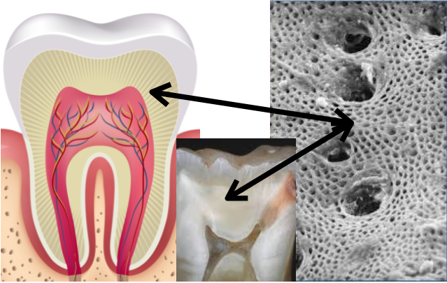Droga usada no tratamento de Alzheimer pode estimular a renovação de células estamínais vivas na polpa dos dentes