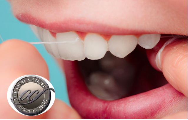 Uso do fio dental e ir ao médico dentista associado a um menor risco de cancro oral