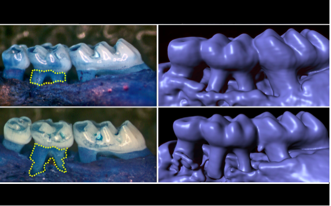 Células sensoriais especiais nas gengivas protegem contra a periodontite