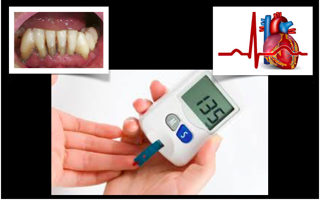Diabetes não detetados  e periodontite podem duplicar o risco de ataque cardíaco