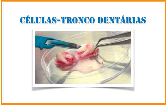 "Leite dos dentes": células-tronco dentárias podem gerar células produtoras de leite