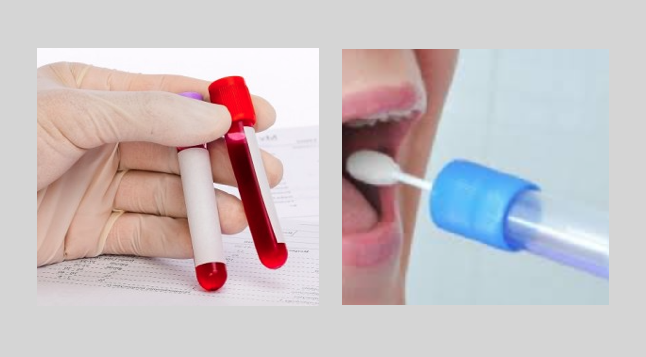 Análise comparativa de perfis de expressão genética do sangue e da saliva  de pacientes com periodontite