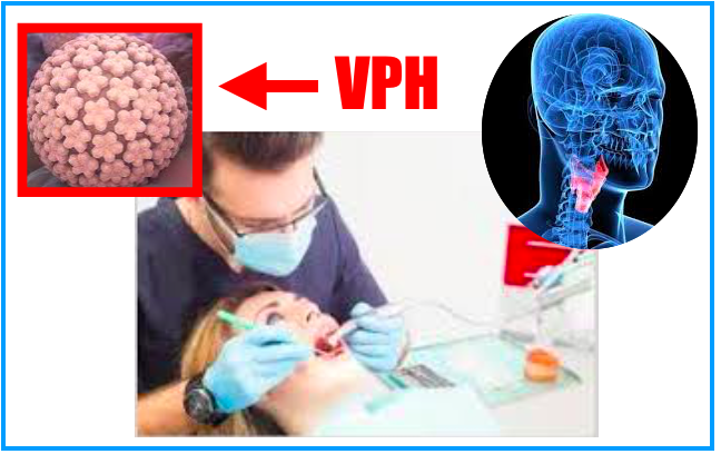 A infeção pelo VPH pode estar na origem do aumento do cancro das cordas vocais entre os jovens não fumadores