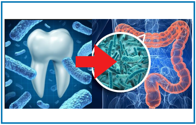 Efeitos da periodontite no microbioma do cólon