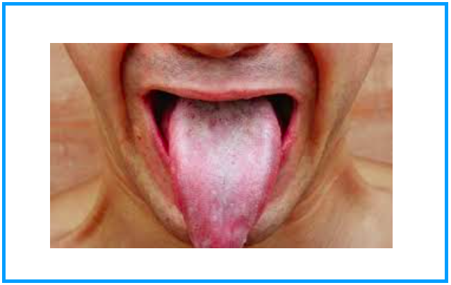 Pesquisa do microbioma de língua mostra importância da Saúde Oral