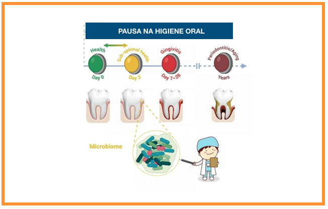 Novo estudo mostra como 24 a 72 horas de má higiene oral impactam a saúde oral