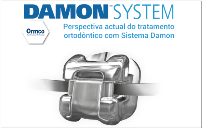 Perspetiva atual do tratamento ortodôntico com Sistema Damon