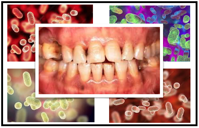 Como a má higiene oral pode resultar em síndrome metabólica