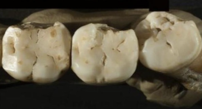 Estudo revela que os dentes podem preservar anticorpos com centenas de anos.
