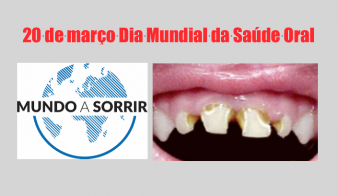 As cáries dentárias são a doença não contagiosa mais comum no mundo