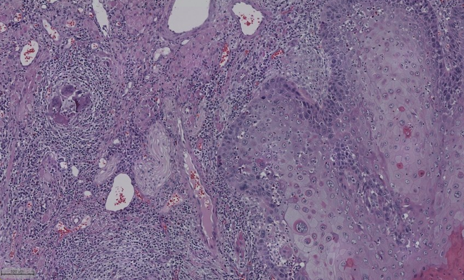 Métrica para articular relação entre densidade nervosa e o cancro oral