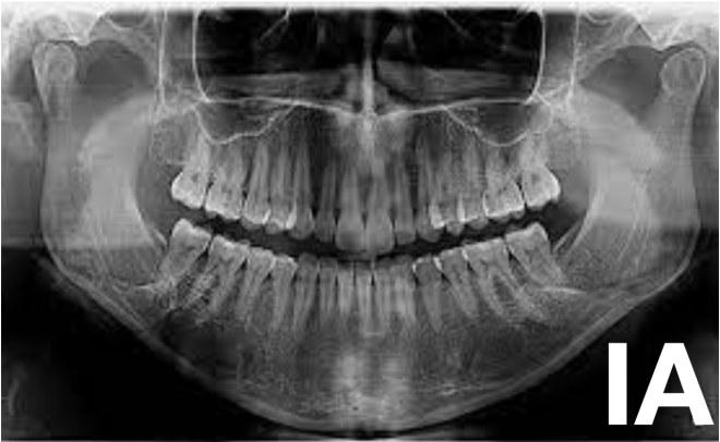Qual o  futuro da IA (Inteligência Artificial) na Medicina Dentária?